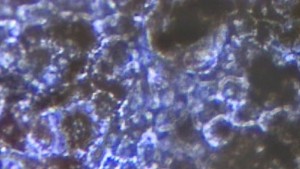 150929175726_stem_cell_cure_640x360_bbc_nocredit